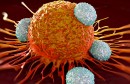 csm_20170718_cellules-cancer_f699f19c74