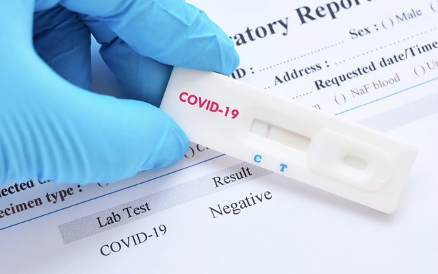 Cellmid-rapid-diagnostic-test-COVID-19-coronavirus-CDY-ASX