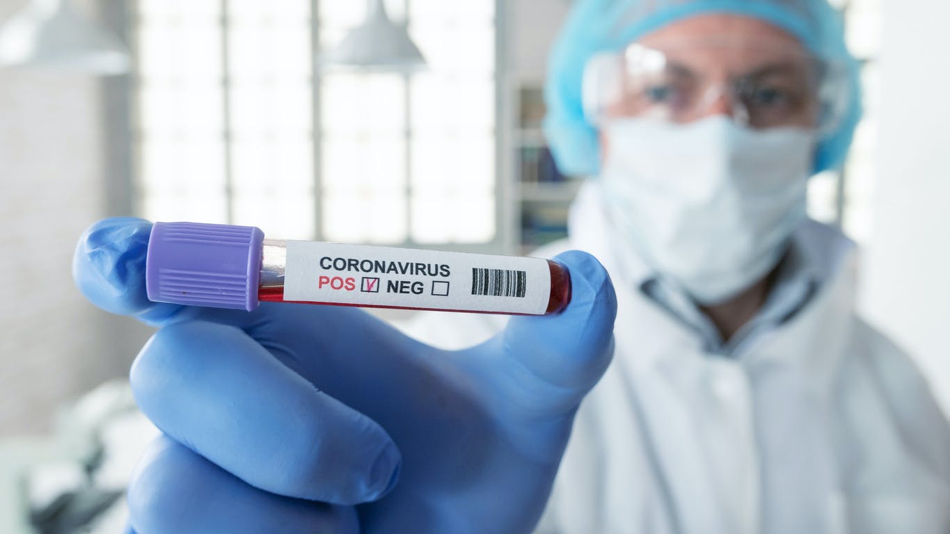 test-etude-coronavirus