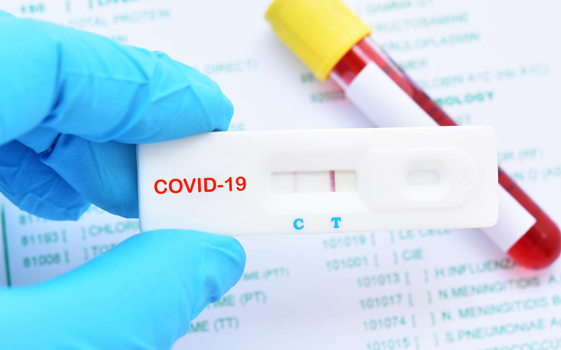 771ad4d351_50162030_test-coronavirus