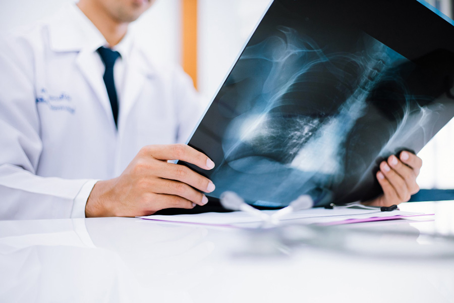 radiology-doctor-examining-chest-x-ray-film-patient-health-care-clinic