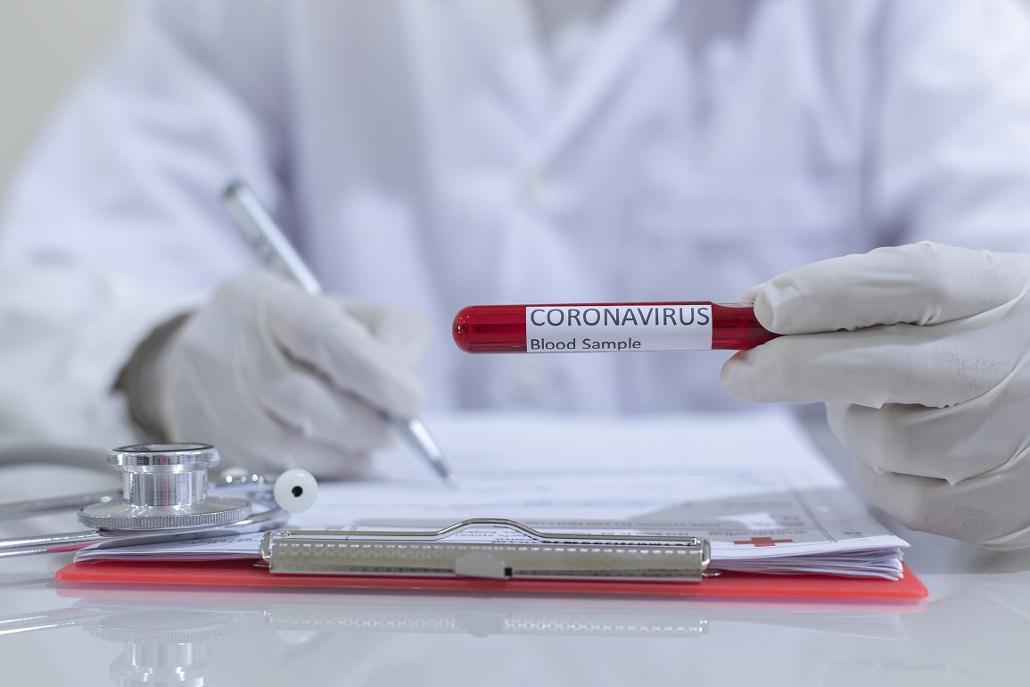Concept to represent the 2020 virus threat Coronavirus, blood in a test tube.
